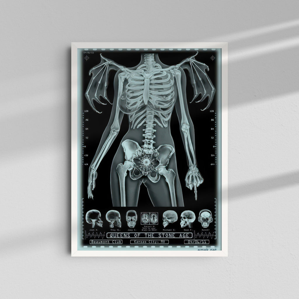 Unknown Band - Skeleton X-Ray