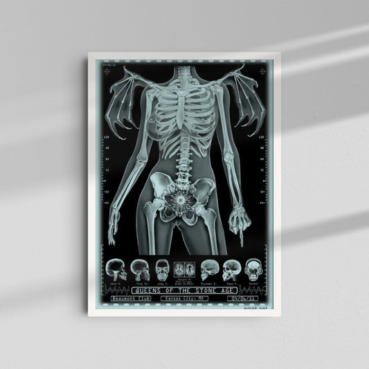 Unknown Band - Skeleton X-Ray