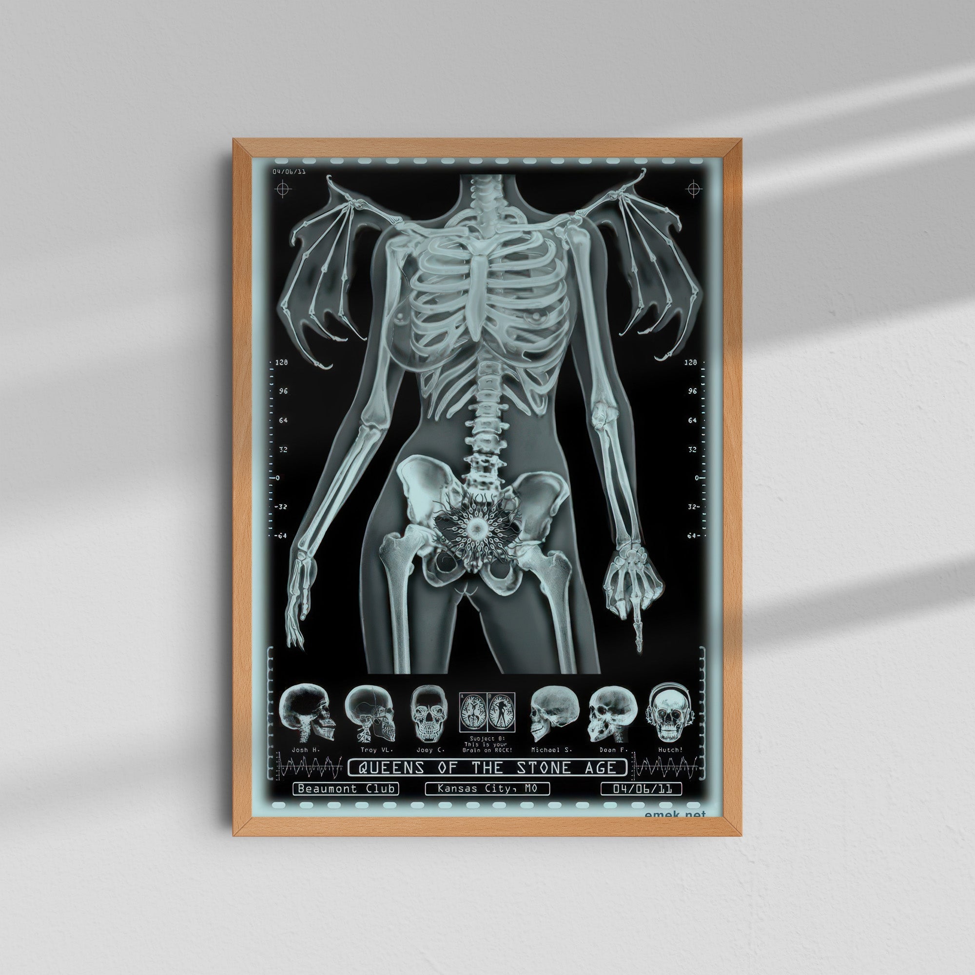 Unknown Band - Skeleton X-Ray