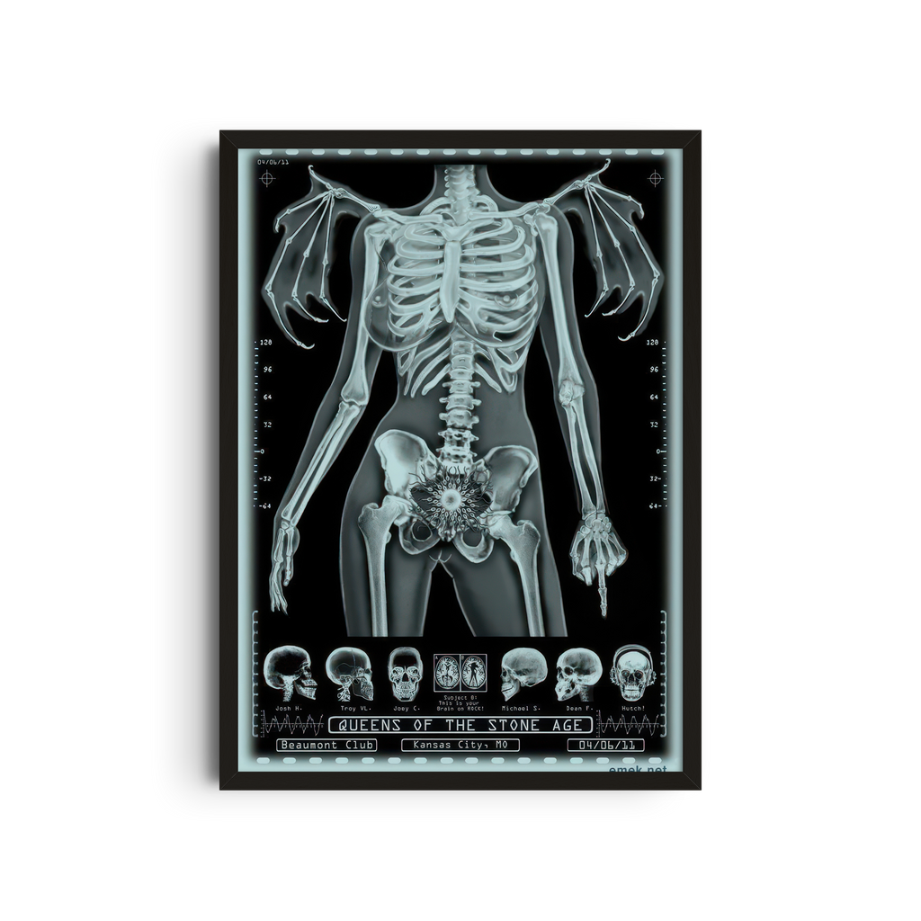 Unknown Band - Skeleton X-Ray