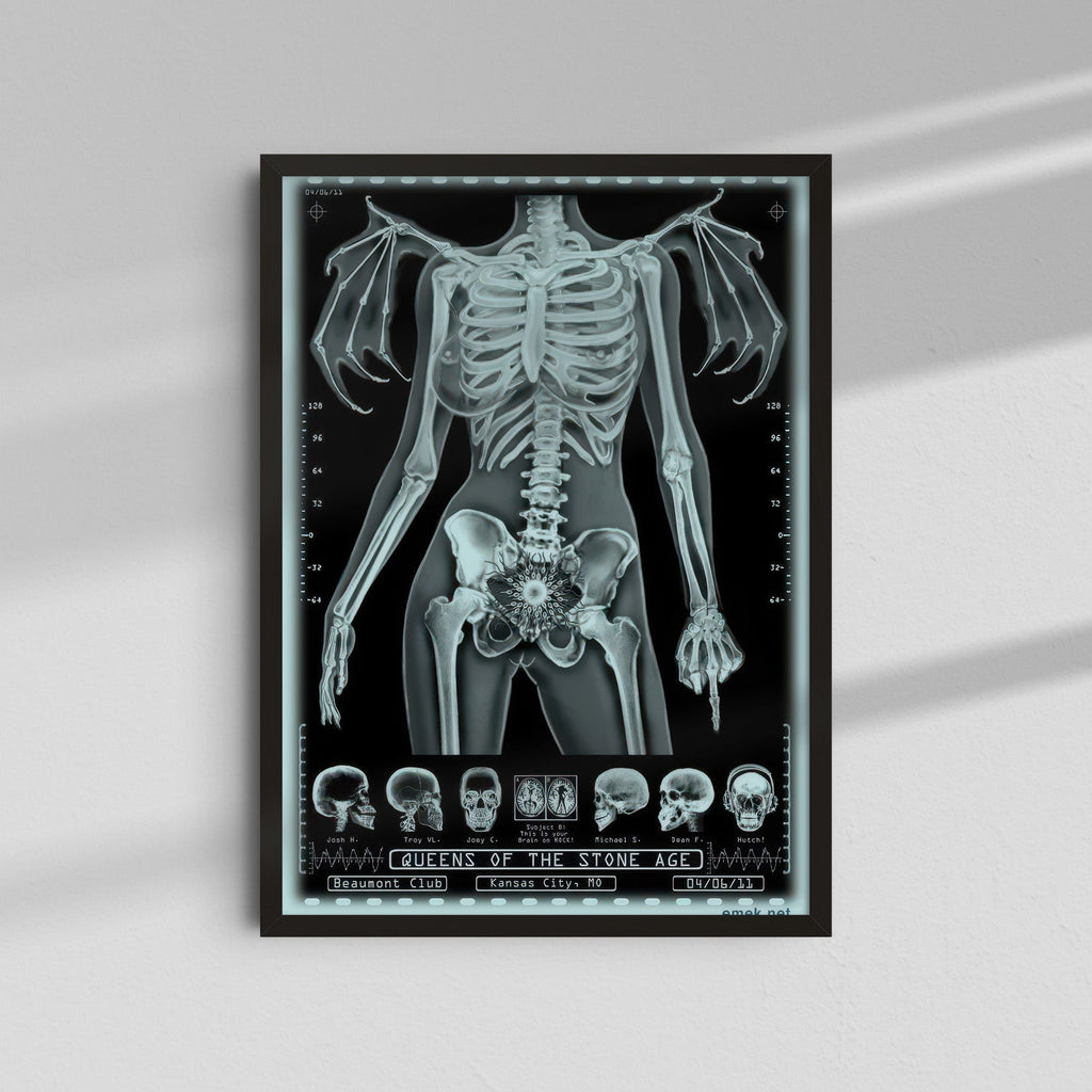 Unknown Band - Skeleton X-Ray