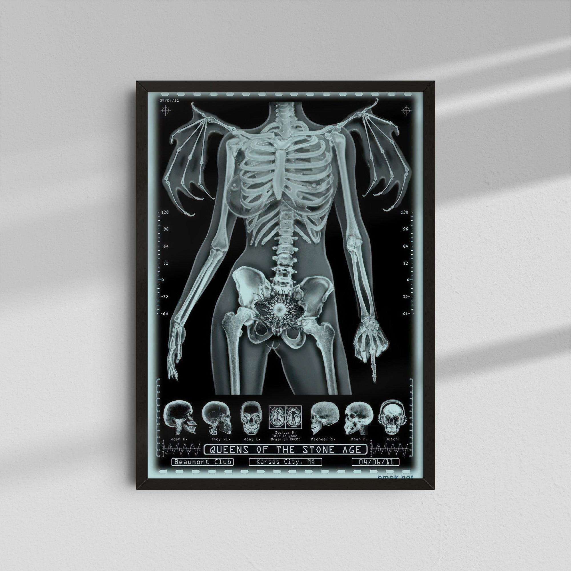 Unknown Band - Skeleton X-Ray